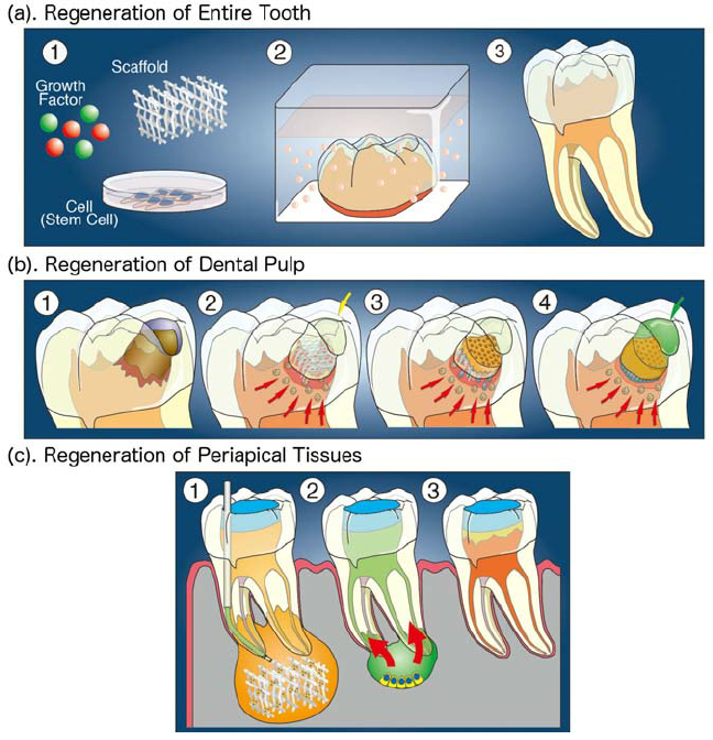 Regeneration of teeth